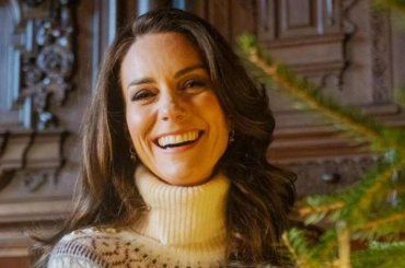 Kate Middleton ne soffre da anni, purtroppo non ci sono cure valide: Elisabetta aveva lo stesso problema