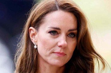 Kate Middleton è irriconoscibile, com’è diventata dopo l’operazione all’addome